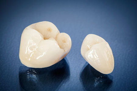 zirconia-crowns.jpg